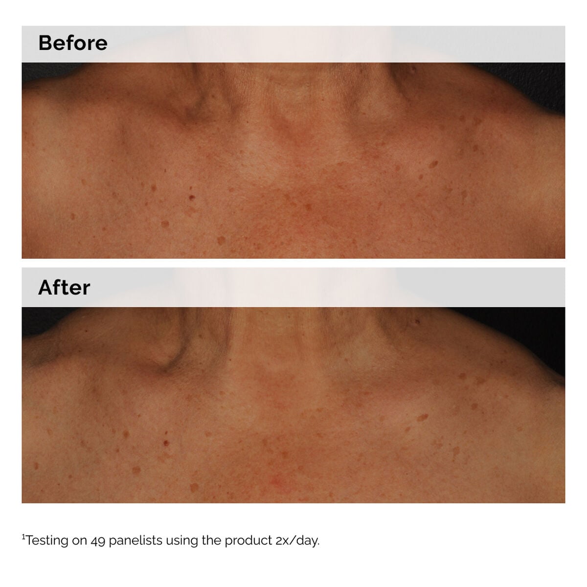 niacinamide-5-face-and-body-emulsion-i2 2024-08-23-ORD-Nia-5pct-Face-Body-B-A-Global-02-1x1.jpg