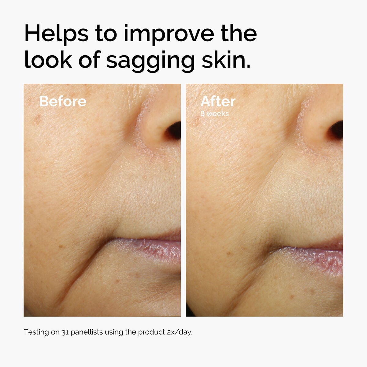 caffeine-3-escin-1-face-serum-l3 ord-caffeine-3pct-escin-1pct-face-serum-before-after-sagging.jpg