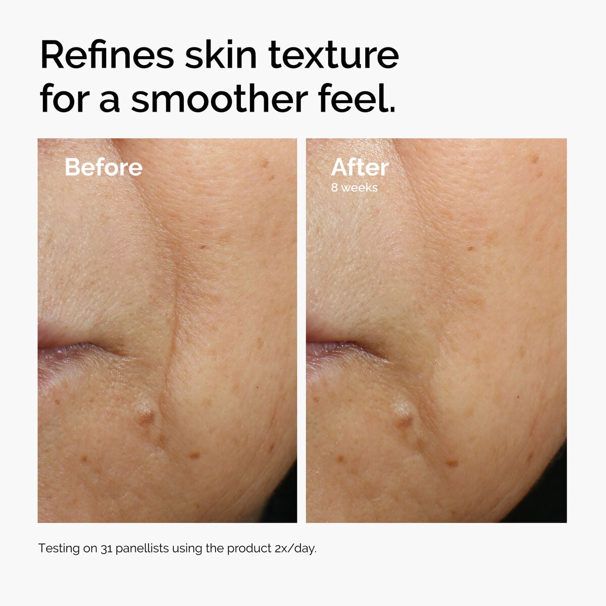 caffeine-3-escin-1-face-serum-l3 ord-caffeine-3pct-escin-1pct-face-serum-before-after-texture.jpg