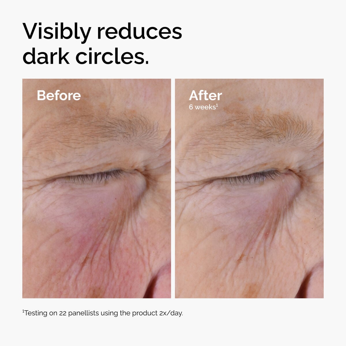 caffeine-solution-5-egcg-eye-serum-u2 ord-caffeine-solution-egcg-dark-circles-before-after.jpg