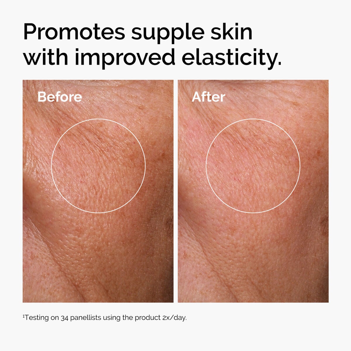 hyaluronic-acid-2-b5-with-ceramides-v4 ord-hyaluronic-acid-2pct-b5-hydrating-serum-before-after-elasticity.jpg