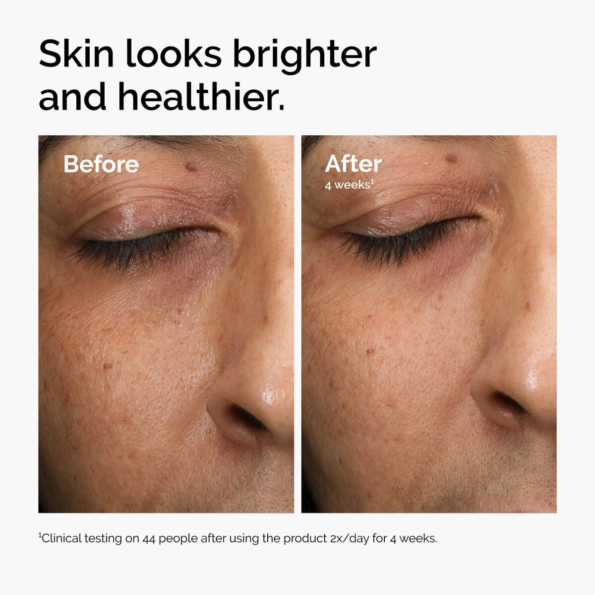 multi-antioxidant-radiance-serum-j3 ord-mars-before-after-healthy.jpg