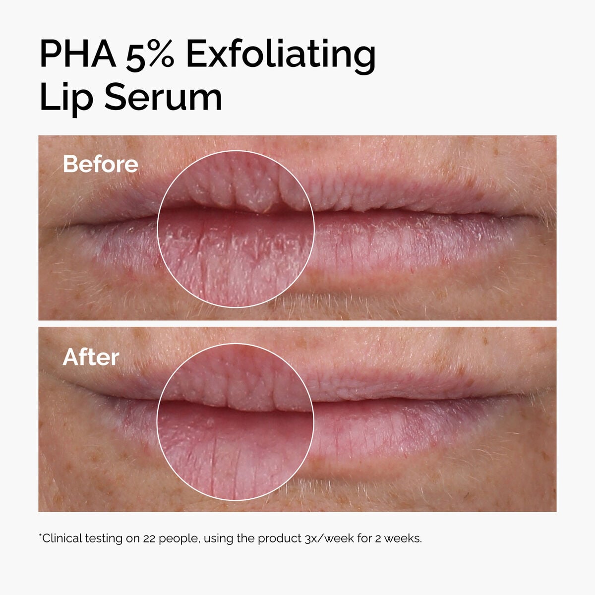 pha-5-exfoliating-lip-serum-a1 ord-pha-5pct-lip-exfoliating-serum-before-after.jpg